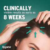 Regaine 2% Topical Hair Regrowth Solution For Men & Women 60ml