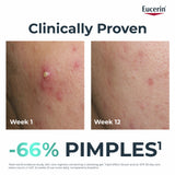 Eucerin Dermopurfyr Post Blemish 3x Effect Serum 40ml