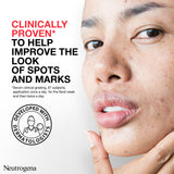 Neutrogena Spot Controlling Daily Serum 30Ml