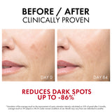 Vichy Liftactiv B3 Dark Spots Serum 30ml