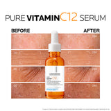 La Roche-Posay Pure Vitamin C12 Serum 30ml