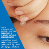 CeraVe Blemish Barrier Patches 22pcs