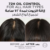 LOREAL ELVIVE HYAL REHYDRATING CONDITIONER 200ML
