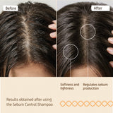 NUGGELA SEBUM CONTROL SHAMPOO 250ML