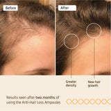 NUGGELA EFFECTIVE ANTI-HAIR LOSS AMP 10ML 4S