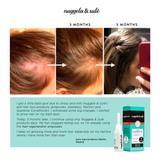 Nuggela & Sule Hair Regenerator Ampoules 10ml 4's