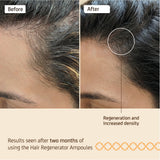 NUGGELA HAIR REGENERATOR AMP 10ML 4S