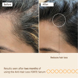 Nuggela Forte Anti-Hair Loss Serum 70Ml