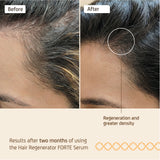 Nuggela Forte Hair Regenerator Serum 70Ml