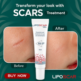 LipoScar Gel 15ml