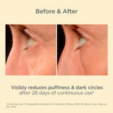 ISDIN Isdinceutics Rejuvenate K-Ox Eyes Cream 15g