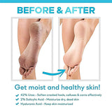 Cerave Sa Renewing Foot Cream 88Ml
