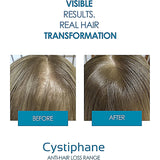 Cystiphane Anti Hairloss Lotion 125ml