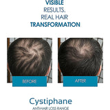 Cystiphane Tablets 120s