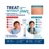 Ialuxid Gel 30ml Tube