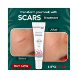 LipoScar Gel 15ml